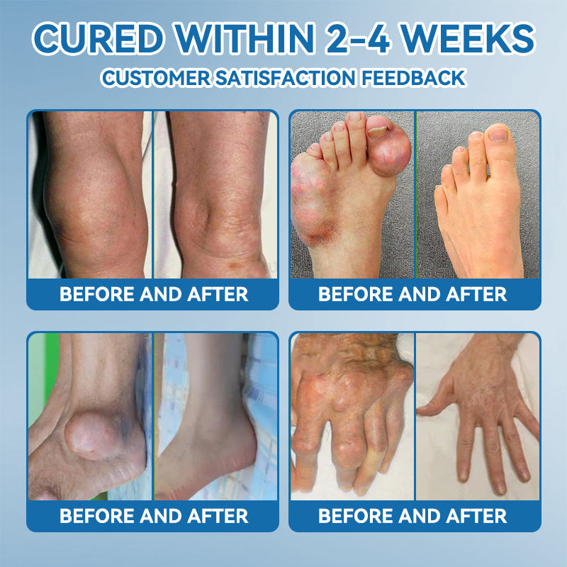 BPC-157 Joint Healing Cream🦴Treats Arthritis, Neuropathy, Rheumatism, Sports Injuries & More👍
