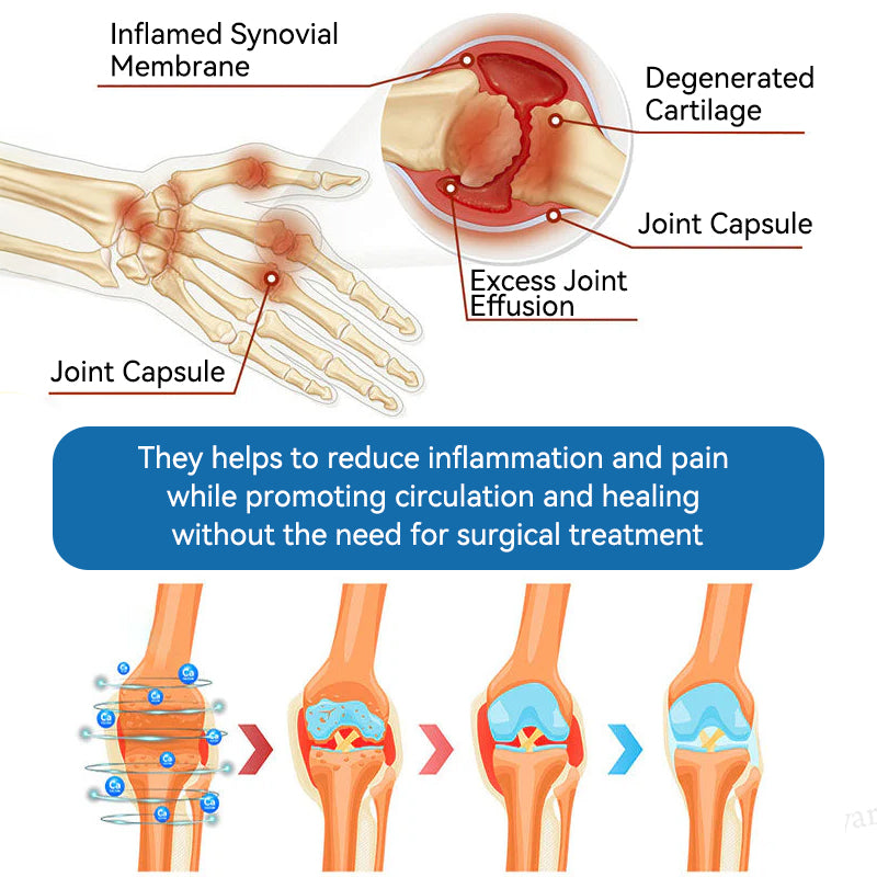 BPC-157 Joint Healing Cream🦴Treats Arthritis, Neuropathy, Rheumatism, Sports Injuries & More👍