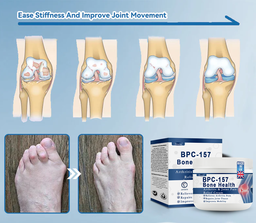 Zvoevo® BPC-157 Joint Repair Cream 👨⚕️ MHRA Certified (Treats arthritis, neuropathy, rheumatism & sports injuries — improves mobility & flexibility)