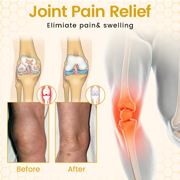 Bee Venom-Infused Relief for Bones  Joints