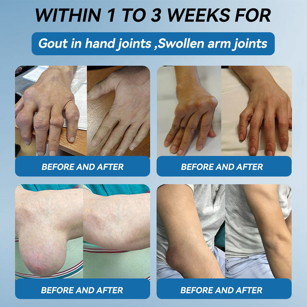 BPC-157 Joint Healing Cream🦴Treats Arthritis, Neuropathy, Rheumatism, Sports Injuries & More👍
