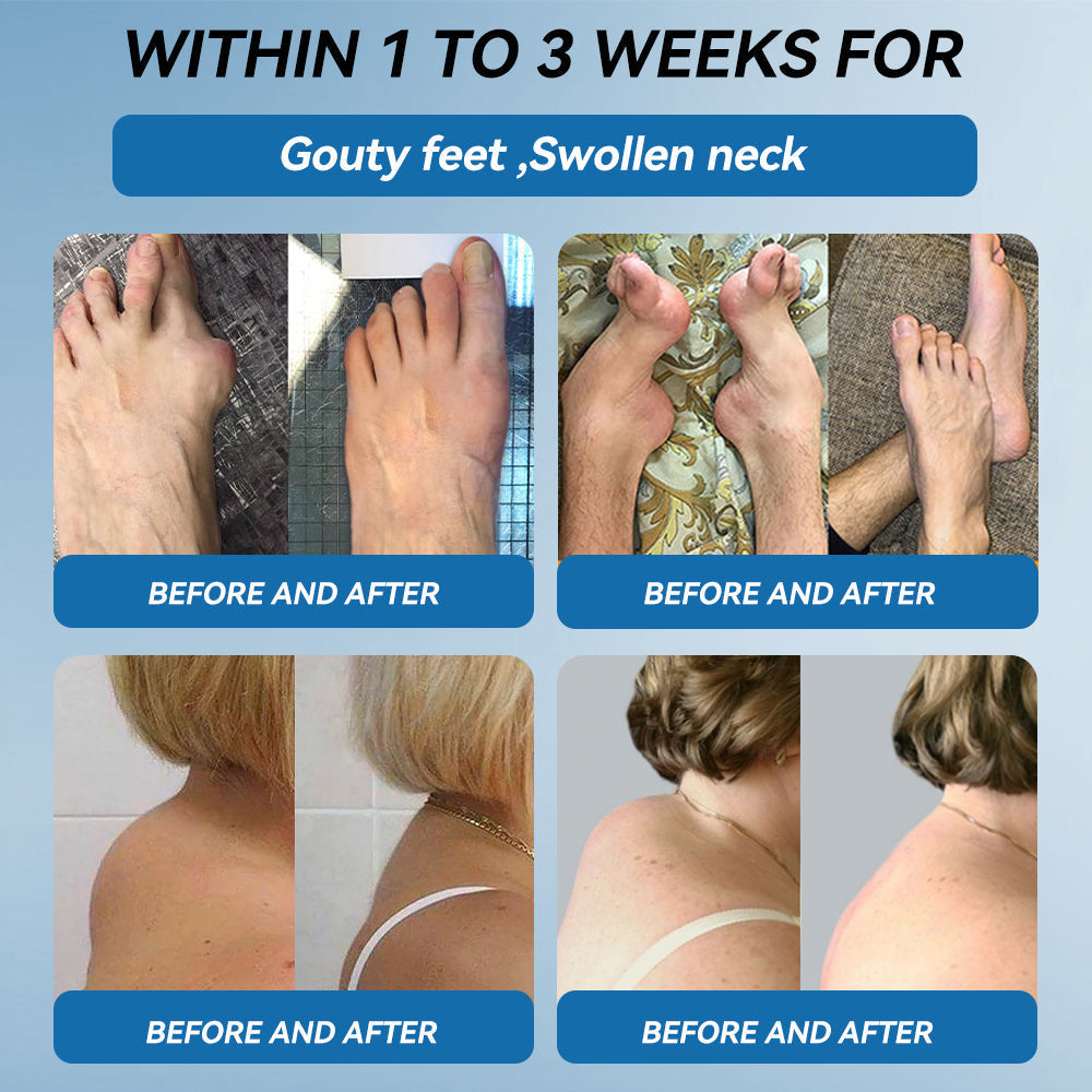 BPC-157 Joint Healing Cream🦴Treats Arthritis, Neuropathy, Rheumatism, Sports Injuries & More👍