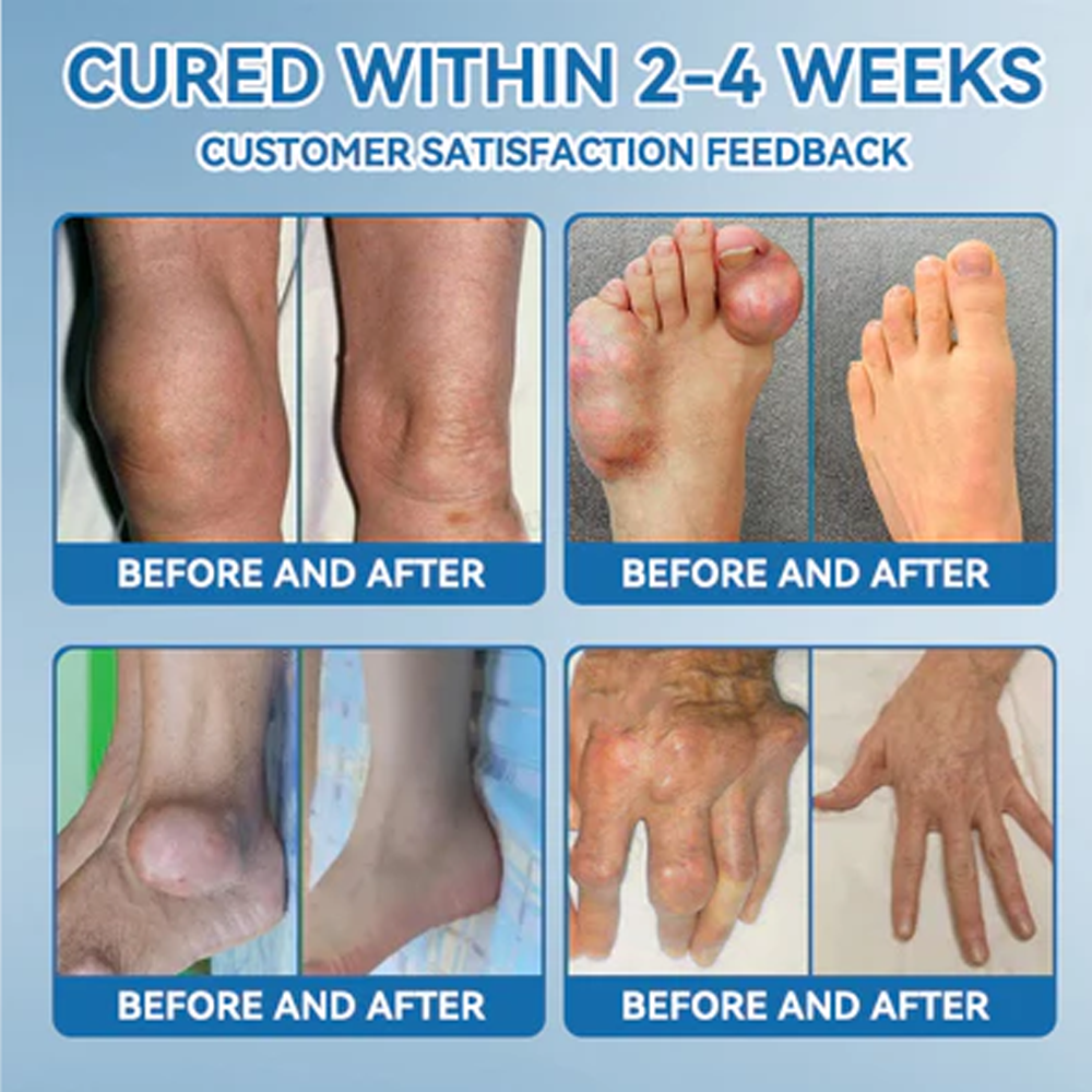 Zvoevo® BPC-157 Joint Repair Cream 👨⚕️ MHRA Certified (Treats arthritis, neuropathy, rheumatism & sports injuries — improves mobility & flexibility)
