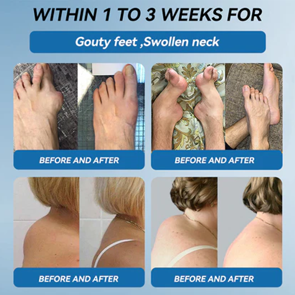 Zvoevo® BPC-157 Joint Repair Cream 👨⚕️ MHRA Certified (Treats arthritis, neuropathy, rheumatism & sports injuries — improves mobility & flexibility)