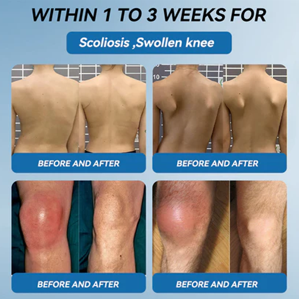 Zvoevo® BPC-157 Joint Repair Cream 👨⚕️ MHRA Certified (Treats arthritis, neuropathy, rheumatism & sports injuries — improves mobility & flexibility)