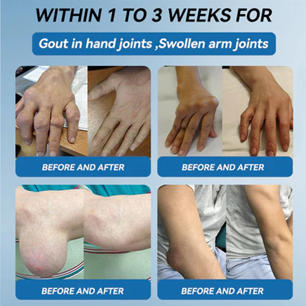 Zvoevo® BPC-157 Joint Repair Cream 👨⚕️ MHRA Certified (Treats arthritis, neuropathy, rheumatism & sports injuries — improves mobility & flexibility)