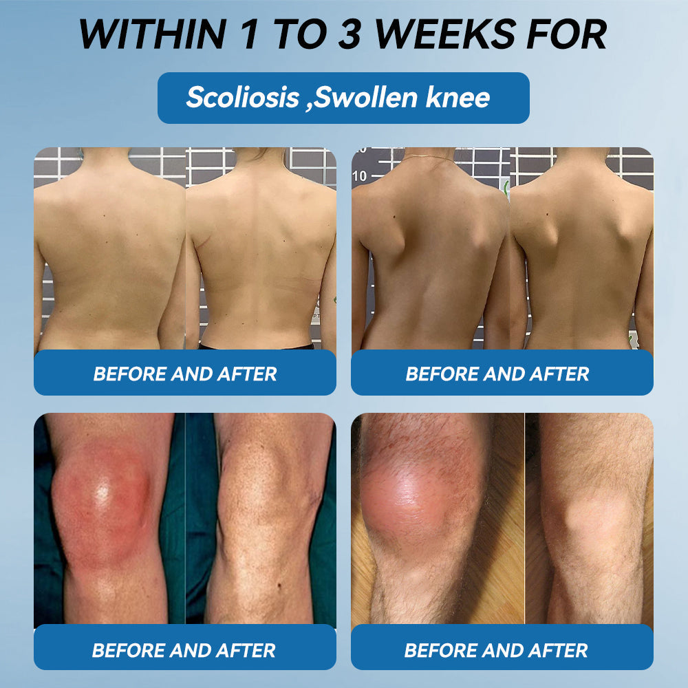 BPC-157 Joint Healing Cream🦴Treats Arthritis, Neuropathy, Rheumatism, Sports Injuries & More👍
